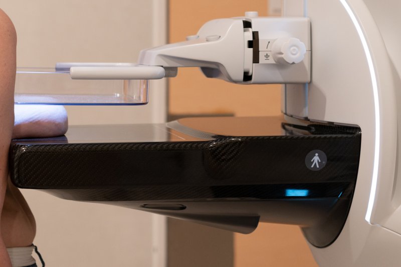 El Hospital de Dnia incorpora un mamgrafo con tecnologa 3D